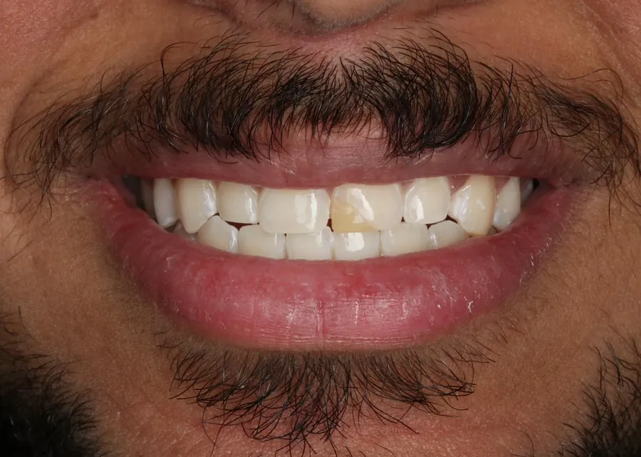 after